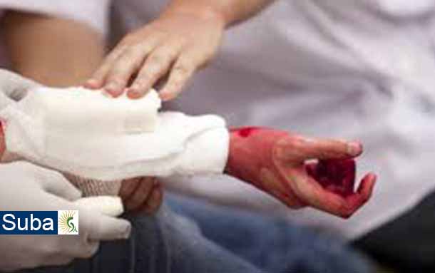 Brutal golpiza contra un joven de 17 años del barrio El Batán en la localidad de Suba