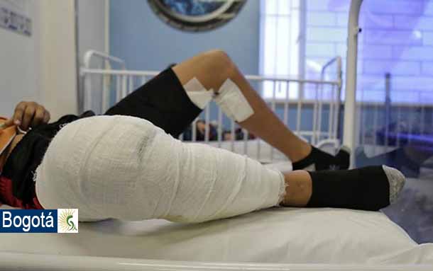 Ya son 15 personas que resultan lesionadas con la pólvora en Bogotá