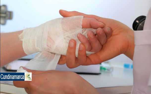 Cundinamarca reduce quemados por pólvora en 40,8%