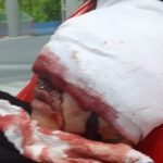 Joven resultó herido en protestas en Suba, se encuentra hospitalizado, busca ayuda económica