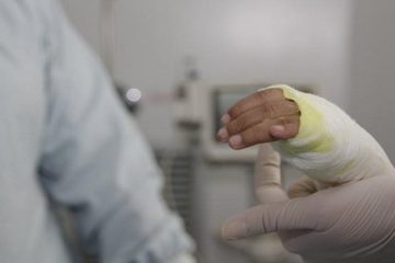 Continúan los quemados por pólvora: Engativá y Suba concentran más casos en la temporada 2025-2026