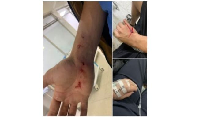 Niño atacado por pitbull desata indignación por paseadores irresponsables en Tuna Alta