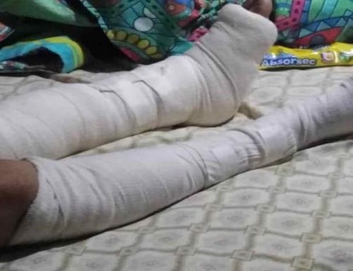 Mujer sufre fracturas en ambas piernas tras violento robo en Suba