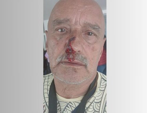 Residente de Lombardía herido por piedra mientras empresa de aseo podaba parque