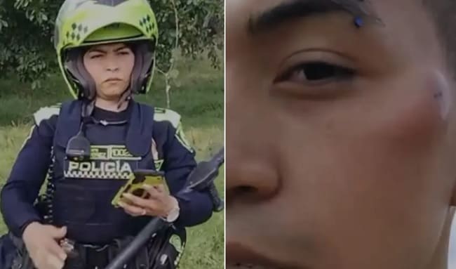 Prorrogan suspensión de policía por agresión con bolillo a joven en el barrio Rincón