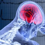 Distrito invita a caminata por la Prevención del Ataque Cerebrovascular