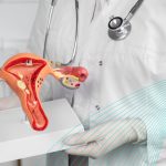 Colombia da un paso firme hacia la eliminación del cáncer de cuello uterino