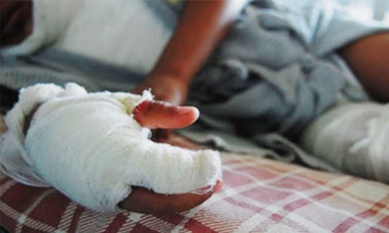 23 personas resultaron lesionadas con pólvora durante el 7 y 8 de diciembre en Bogotá