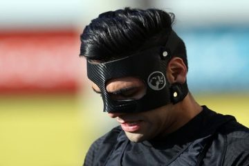 Falcao enciende las alarmas: el panorama clínico tras su fuerte choque en el rostro